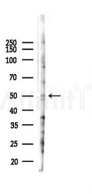 CAP2 Antibody - Western blot analysis of lysates from 293 cells(heat-shock 45min treatment), using CAP2 Antibody at 1/1000 dilution.