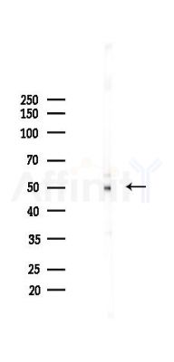 MEIS1 Antibody - Western blot analysis of lysates from A2780 cells(starvation 24h treatment), using MEIS1 Antibody at 1/1000 dilution.
