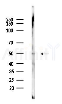 CARD9 Antibody - Western blot analysis of lysates from Rat kidney, using CARD9 Antibody at 1/1000 dilution.