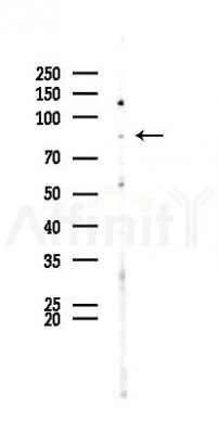 PROX1 Antibody - Western blot analysis of lysates from B16F10-LUC cells(UV 30min treatment), using PROX1 Antibody at 1/1000 dilution.