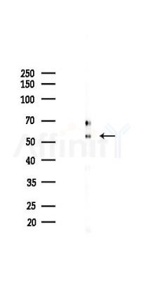 TLS/FUS Antibody - Western blot analysis of lysates from A2780 cells(starvation 24h treatment), using TLS/FUS Antibody at 1/1000 dilution.