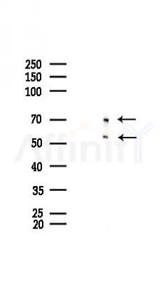 TLS/FUS Antibody - Western blot analysis of lysates from Hela cells(starvation 24h treatment), using TLS/FUS Antibody at 1/1000 dilution.