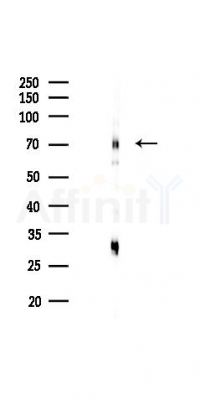 TLS/FUS Antibody - Western blot analysis of lysates from Rat testis, using TLS/FUS Antibody at 1/1000 dilution.