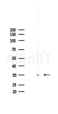 Stanniocalcin 1 Antibody - Western blot analysis of lysates from A2780 cells(starvation 24h treatment), using Stanniocalcin 1 Antibody at 1/1000 dilution.