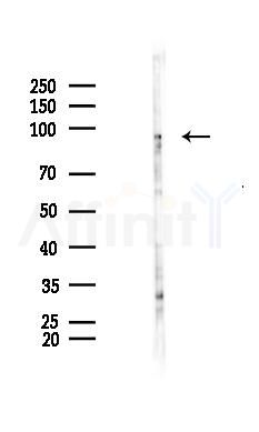 SUN2 Antibody - Western blot analysis of lysates from Hela cells(starvation 24h treatment), using SUN2 Antibody at 1/1000 dilution.