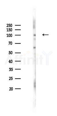SUN2 Antibody - Western blot analysis of lysates from Rat testis, using SUN2 Antibody at 1/1000 dilution.