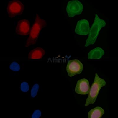 FTO Antibody - DF8421 staining Hela cells(30min of UV treatment) by IF/ICC.