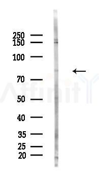 THOC5 Antibody - Western blot analysis of lysates from Hela cells(heat-shock 45min treatment), using THOC5 Antibody at 1/1000 dilution.