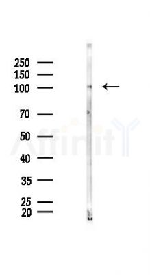 EIF3B Antibody - Western blot analysis of lysates from Hela cells(starvation 24h treatment), using EIF3B Antibody at 1/1000 dilution.