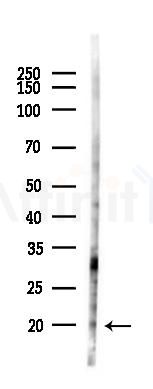 ARF5 Antibody - Western blot analysis of lysates from 293 cells(heat-shock 45min treatment), using ARF5 Antibody at 1/1000 dilution.