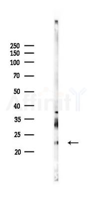 ADM Antibody - Western blot analysis of lysates from Rat testis, using ADM Antibody at 1/1000 dilution.