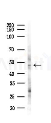 Ameloblastin Antibody - Western blot analysis of lysates from Hela cells(heat-shock 45min treatment), using Ameloblastin Antibody at 1/1000 dilution.