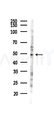 Ameloblastin Antibody - Western blot analysis of lysates from 293 cells(heat-shock 45min treatment), using Ameloblastin Antibody at 1/1000 dilution.