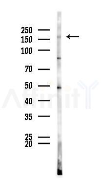 ATP7A Antibody - Western blot analysis of lysates from B16F10-LUC cells(UV 30min treatment), using ATP7A Antibody at 1/1000 dilution.