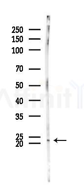 CD179b Antibody - Western blot analysis of lysates from B16F10-LUC cells(UV 30min treatment), using CD179b Antibody at 1/1000 dilution.