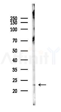 CD179b Antibody - Western blot analysis of lysates from Mouse lung, using CD179b Antibody at 1/1000 dilution.