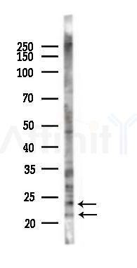 CD179b Antibody - Western blot analysis of lysates from 293 cells(heat-shock 45min treatment), using CD179b Antibody at 1/1000 dilution.