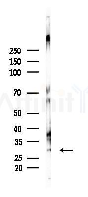 NET-5 Antibody - Western blot analysis of lysates from Mouse liver, using NET-5 Antibody at 1/1000 dilution.