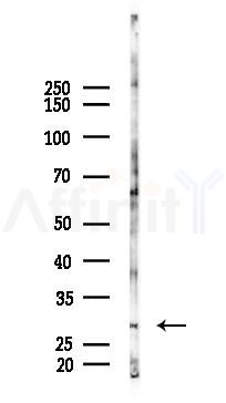 NET-5 Antibody - Western blot analysis of lysates from A2780 cells(starvation 24h treatment), using NET-5 Antibody at 1/1000 dilution.