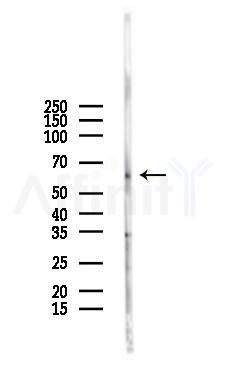 OCT1 Antibody - Western blot analysis of lysates from Rat liver, using OCT1 Antibody at 1/1000 dilution.
