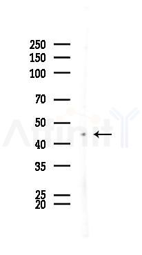 RAP1 Antibody - Western blot analysis of lysates from B16F10-LUC cells(UV 30min treatment), using RAP1 Antibody at 1/1000 dilution.