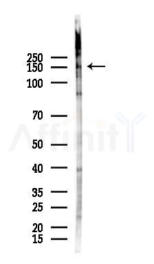 RNase III Drosha Antibody - Western blot analysis of lysates from Mouse lung, using RNase III Drosha Antibody at 1/1000 dilution.