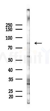 SEMA3C Antibody - Western blot analysis of lysates from A2780 cells(starvation 24h treatment), using SEMA3C Antibody at 1/1000 dilution.
