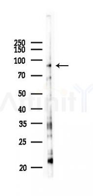 SEMA4C Antibody - Western blot analysis of lysates from HUVEC cells(UV 30min treatment), using SEMA4C Antibody at 1/1000 dilution.