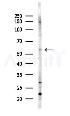 St3Gal-III Antibody - Western blot analysis of lysates from Hela cells(heat-shock 45min treatment), using St3Gal-III Antibody at 1/1000 dilution.