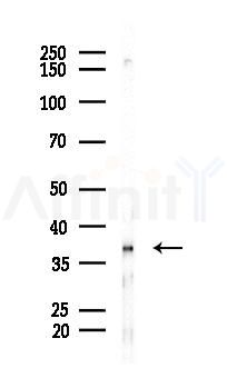 CD2 Tail-binding Antibody - Western blot analysis of lysates from A2780 cells(starvation 24h treatment), using CD2 Tail-binding Antibody at 1/1000 dilution.