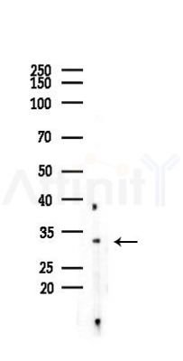 DHRS8 Antibody - Western blot analysis of lysates from COLO205 cells(heat-shock 45min treatment), using DHRS8 Antibody at 1/1000 dilution.