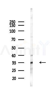 DOK5 Antibody - Western blot analysis of lysates from Mouse heart, using DOK5 Antibody at 1/1000 dilution.