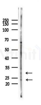 EIF4E3 Antibody - Western blot analysis of lysates from COLO205 cells(heat-shock 45min treatment), using EIF4E3 Antibody at 1/1000 dilution.