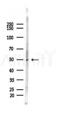 NARF Antibody - Western blot analysis of lysates from Rat testis, using NARF Antibody at 1/1000 dilution.