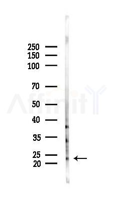 RAB35 Antibody - Western blot analysis of lysates from PC12 cells(UV 30min treatment), using RAB35 Antibody at 1/1000 dilution.