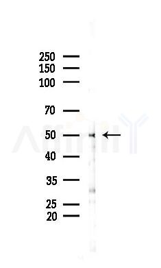 RELT Antibody - Western blot analysis of lysates from PC12 cells(UV 30min treatment), using RELT Antibody at 1/1000 dilution.