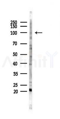 RHPN1 Antibody - Western blot analysis of lysates from COLO205 cells(heat-shock 45min treatment), using RHPN1 Antibody at 1/1000 dilution.