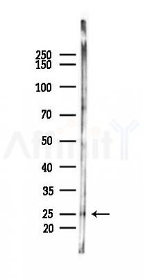TP53INP1 Antibody - Western blot analysis of lysates from Rat testis, using TP53INP1 Antibody at 1/1000 dilution.