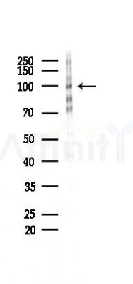 Phospho-WEE1 (Ser642) Antibody - Western blot analysis of lysates from COLO205 cells(heat-shock 45min treatment), using Phospho-WEE1 (Ser642) Antibody at 1/1000 dilution.