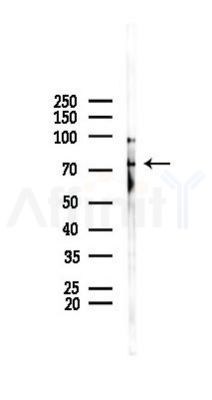 ZNF7 Antibody - Western blot analysis of lysates from Rat testis, using ZNF7 Antibody at 1/1000 dilution.
