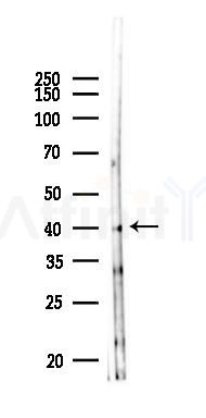 MRP Antibody - Western blot analysis of lysates from HUVEC cells(UV 30min treatment), using MRP Antibody at 1/1000 dilution.