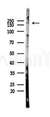 AKAP12 Antibody - Western blot analysis of lysates from COLO205 cells(heat-shock 45min treatment), using AKAP12 Antibody at 1/1000 dilution.