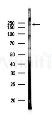 AKAP12 Antibody - Western blot analysis of lysates from HUVEC cells(UV 30min treatment), using AKAP12 Antibody at 1/1000 dilution.