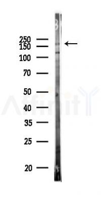 ERCC6 Antibody - Western blot analysis of lysates from HUVEC cells(UV 30min treatment), using ERCC6 Antibody at 1/1000 dilution.