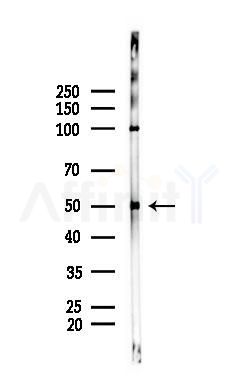 EGR3 Antibody - Western blot analysis of lysates from PC12 cells(UV 30min treatment), using EGR3 Antibody at 1/1000 dilution.