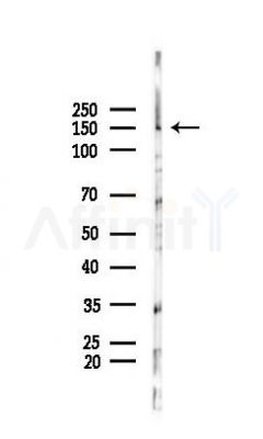 MAP3K15 Antibody - Western blot analysis of lysates from PC12 cells(UV 30min treatment), using MAP3K15 Antibody at 1/1000 dilution.
