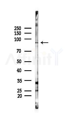 FAKD5 Antibody - Western blot analysis of lysates from PC12 cells(UV 30min treatment), using FAKD5 Antibody at 1/1000 dilution.