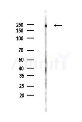 ARHGEF17 Antibody - Western blot analysis of lysates from Rat liver, using ARHGEF17 Antibody at 1/1000 dilution.