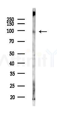 PKD1/2/3 Antibody - Western blot analysis of lysates from K562 cells(LPS 4h treatment), using PKD1/2/3 Antibody at 1/1000 dilution.