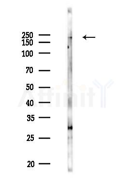 AKAP11 Antibody - Western blot analysis of lysates from PC12 cells(UV 30min treatment), using AKAP11 Antibody at 1/1000 dilution.